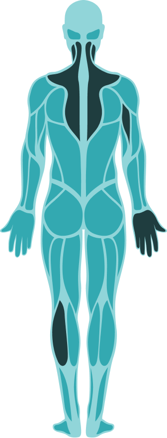 Mapa corporal muscular